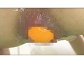性感アナルエステサロン 2