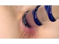 女子校生 アナル健康診断