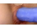 女子校生 アナル健康診断