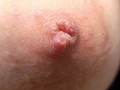 100人の乳首 第1集