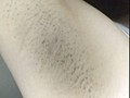 腋臭女 第8集
