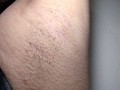 腋臭女 第9集