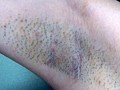 100人のわき 第2集