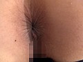 日本女性の肛門