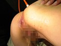 お花見浣腸三昧！大勢のお花見客の中で強制浣腸！アナルモザ無しVer！